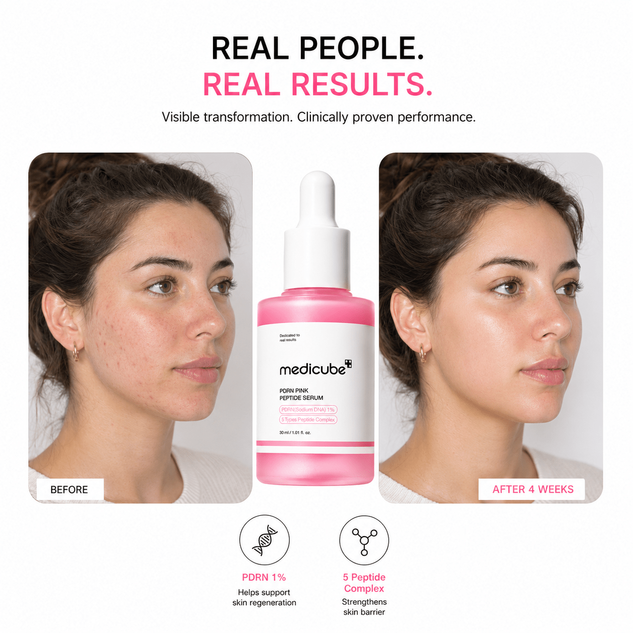 Acne Marks Serum - Eleza